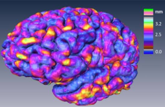 corteza cerebral