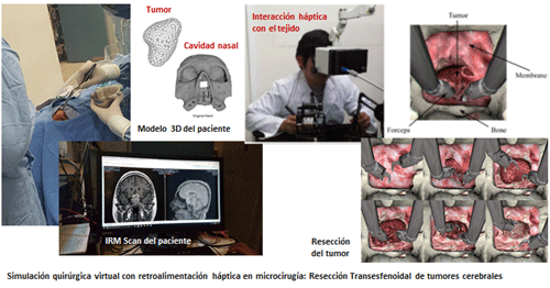 simulacion quirurgica virtual