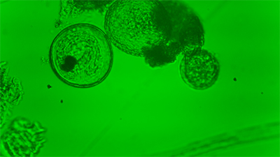 Imagen de huevos de Helminto obtenidas con un microscopio casero de bajo costo con iluminación por transmisión.