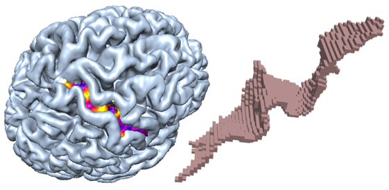 Pial surface (brin cortex) and the right central sulcus- Color labels is the local width. We also designed a 3D tortuosity descriptor. PhD thessis of Julieta Mateos ( advisor JM).