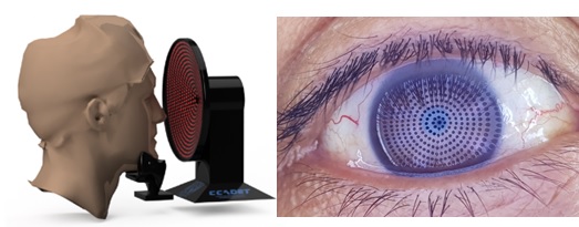 Conical corneal topographer with null screens